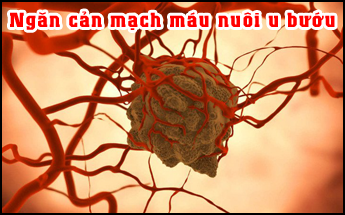 Ngăn chặn quá trình hình thành mạch máu mới của tế bào u bướu